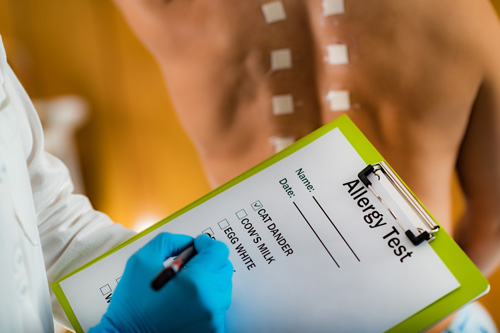 pruebas de alergias